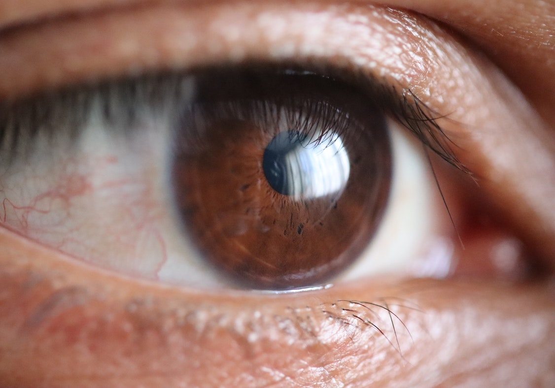 dry eye treatment